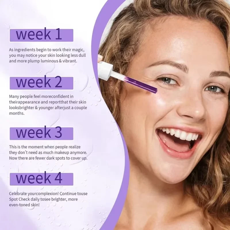 فيتامين B3 مصل الوجه نياسيناميد 5% فيتانين E حمض الهياكورونيك إزالة البقع السوداء النمش تتلاشى الميلانين التصبغ سطع