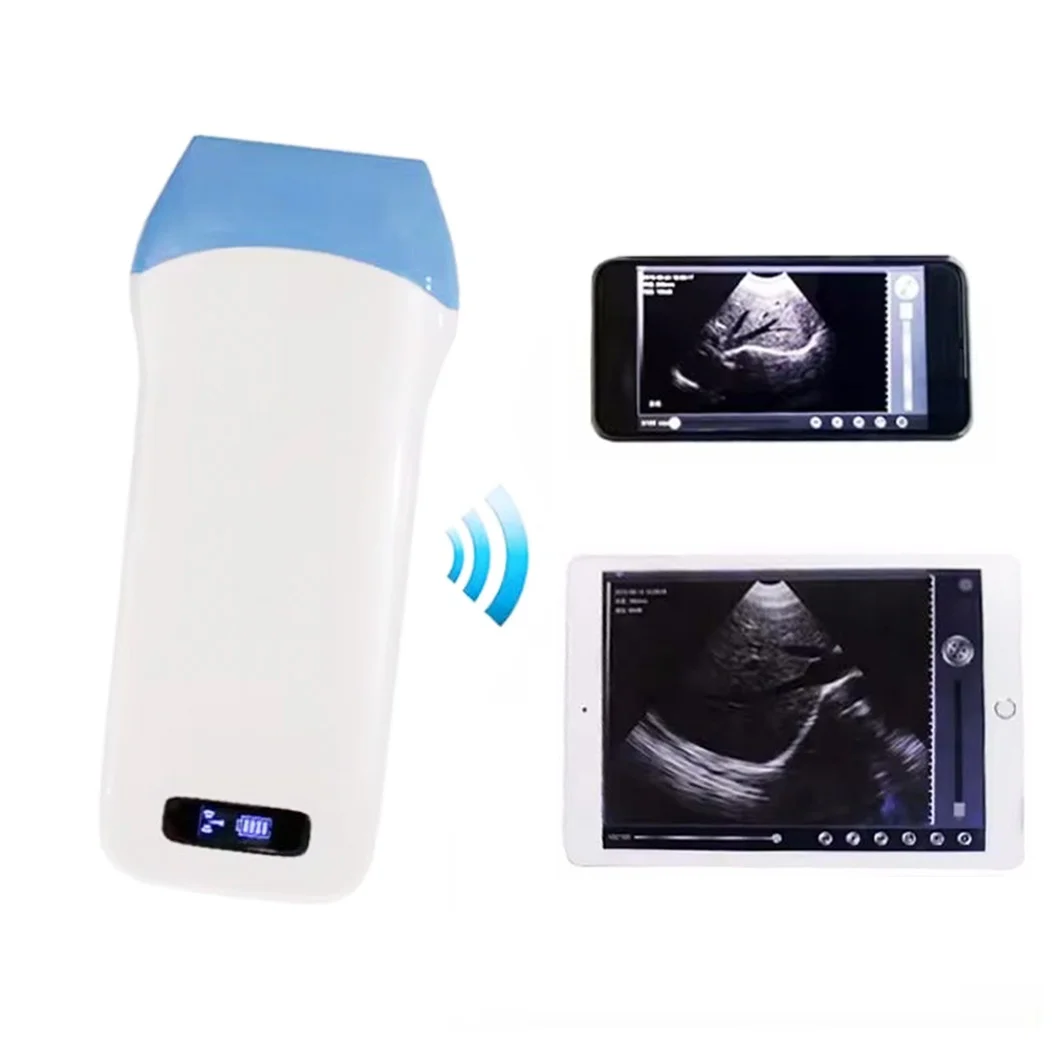 UProbe-5L New Arrival Palm Linear Palm B/W Ultrasound Scanner Wireless Probe Type Ultrasound Scanner For Mobile Phone And Ipad