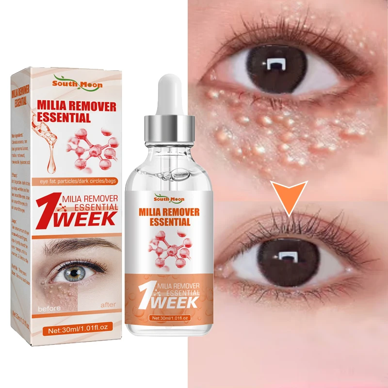 Fat Granules Removal Eye Serum Eye Milia Repair Treatment Products Wrinkle Lifting Moisturizing Anti-Puffiness Korean Skin Care