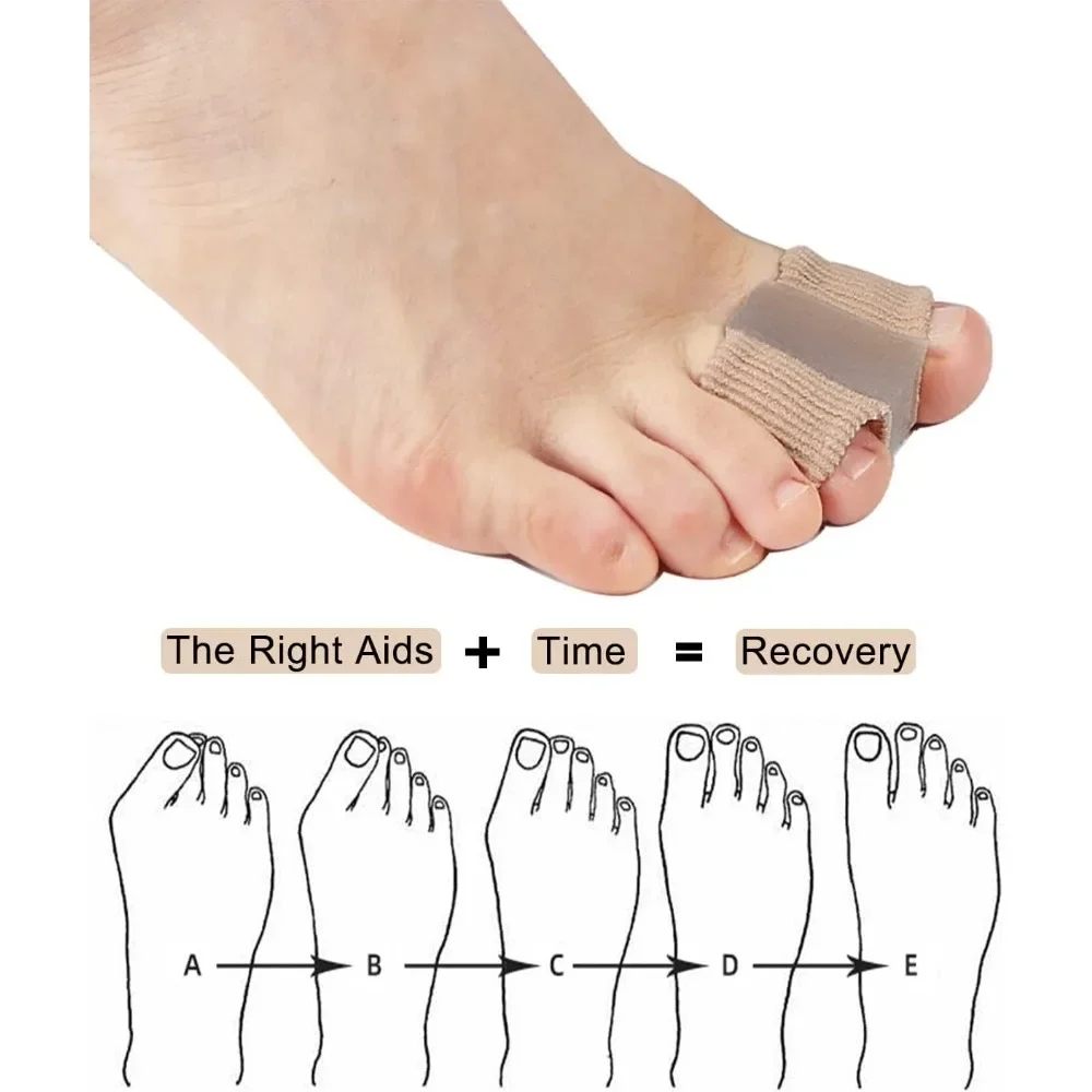 Separador de dos dedos de los pies, Corrector ortopédico de juanete Hallux Valgus, ajustador de pulgar y hueso de los pies, Corrector de pedicura, 1/2 unidades