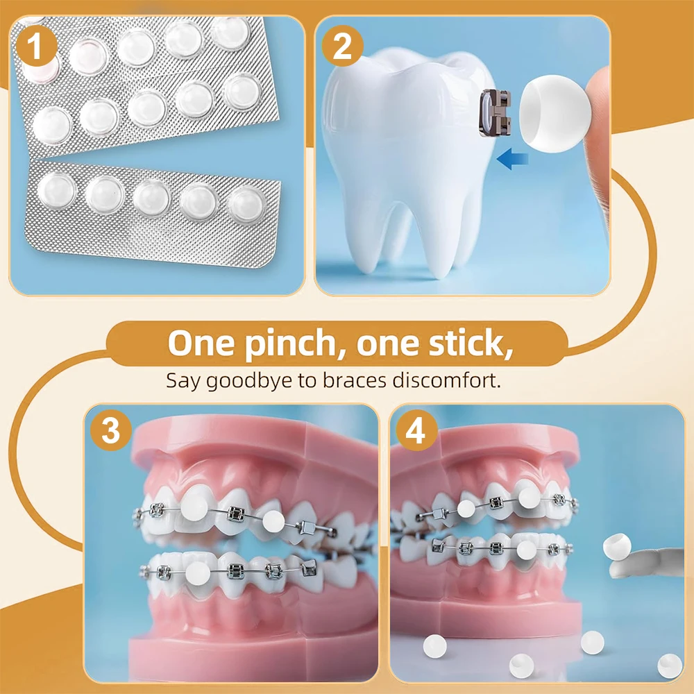 60pc Dental Orthodontic Wax For Braces Gum Portable Fruit Flavor Granular Orthodontic Protective Wax Dots Box Individual Package