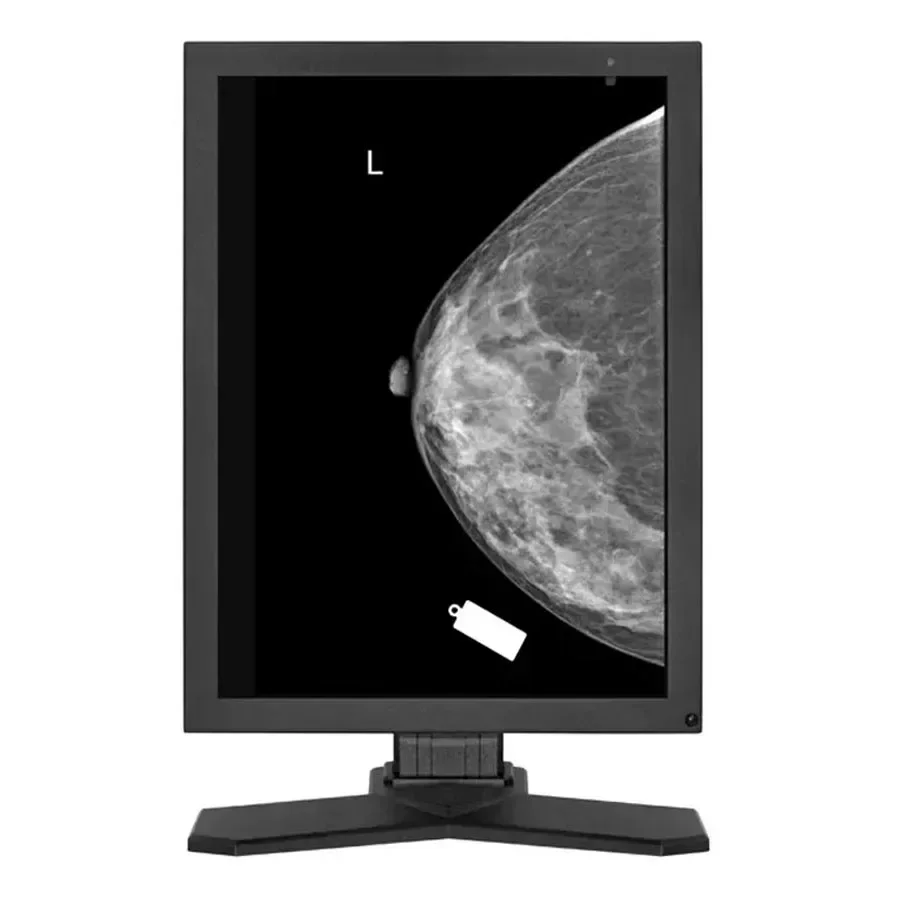 Clinical Viewing Displayer 5MP MD52G Digital Mammography Diagnostic Medical Display 5MP Gray Medical Display