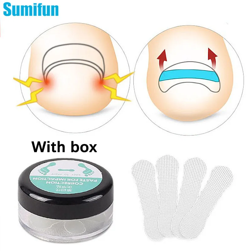 

10/30/50Pcs Nail Correction Stickers Ingrown Toenail Corrector Patches Treatment Paronychia Recover Corrector Pedicure Care Tool