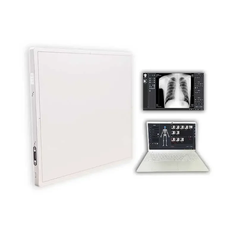 1717X Portable Medical Imaging Equipment 17*17 Inch X Ray Flat Panel Digital Detector