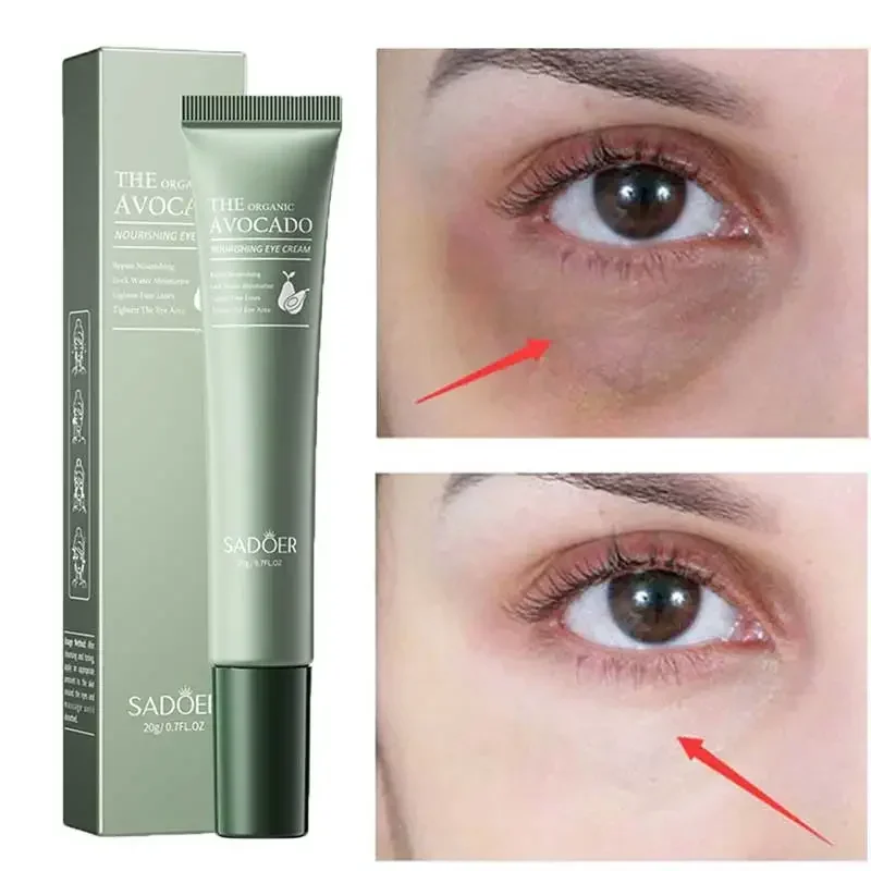 

Eye Cream Quickly Lightens Dark Circles Under The Eyes Removes Puffiness Under The Eyes Resists Wrinkles Soothes Dry Skin