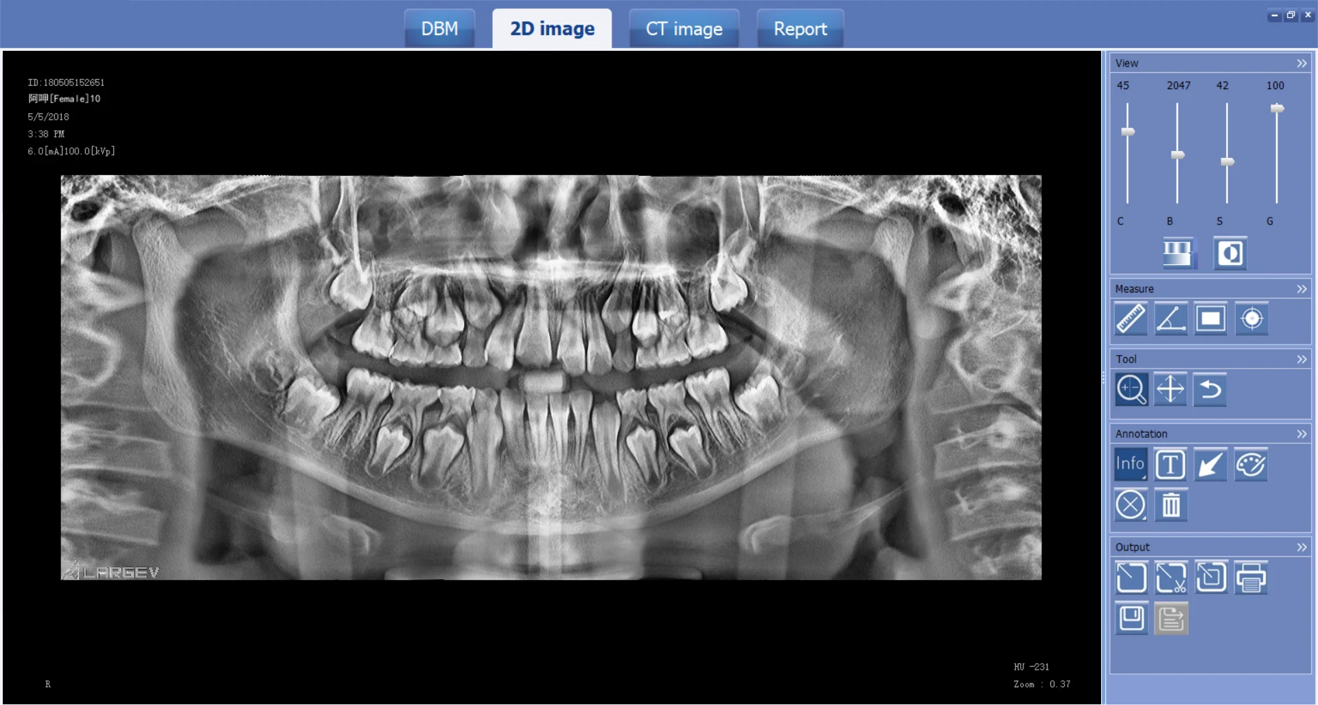 Newest cbct den  tal x ray machine equipments