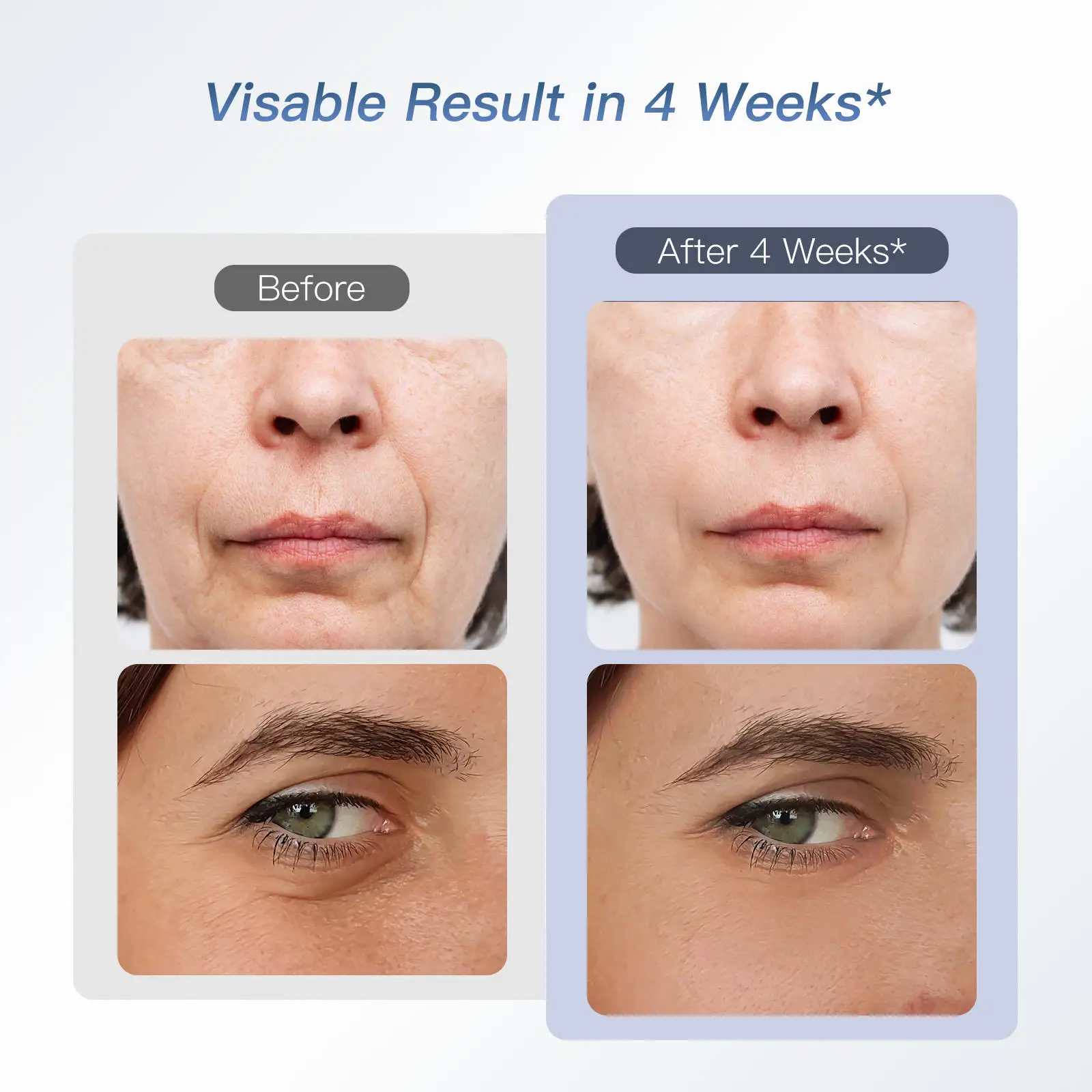 6 in 1 Skin Rejuvenation Face Massager Photon Facial Lifting Beauty Machine