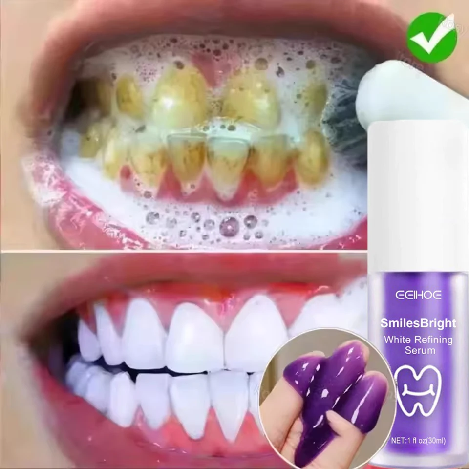 معجون أسنان مبيض لتنظيف الأسنان، مبيض جل مبيض يزيل البقع، منتجات كوريا لتنظيف الأسنان منعشة