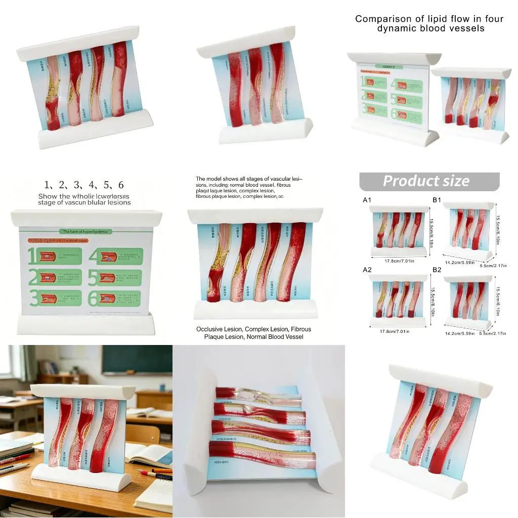  Anatomical Vascular Teaching Model Demonstrating Blood Circulation And Various Diseases Conditions For Classroom Use