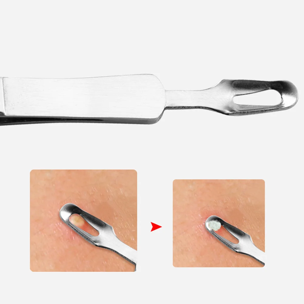 Mole Removal Scissor Clip Kit Blackhead Extractor โลหะสิวเครื่องมือ Silver