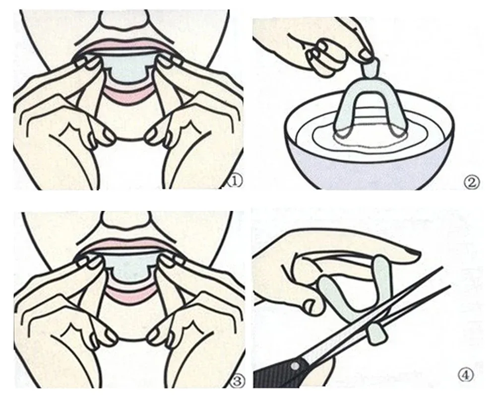 Anti Snoring Bruxism Sleeping Mouth Guard Night Guard Gum Shield Mouth Tray Stop Teeth Grinding Sleep Aid Health Care