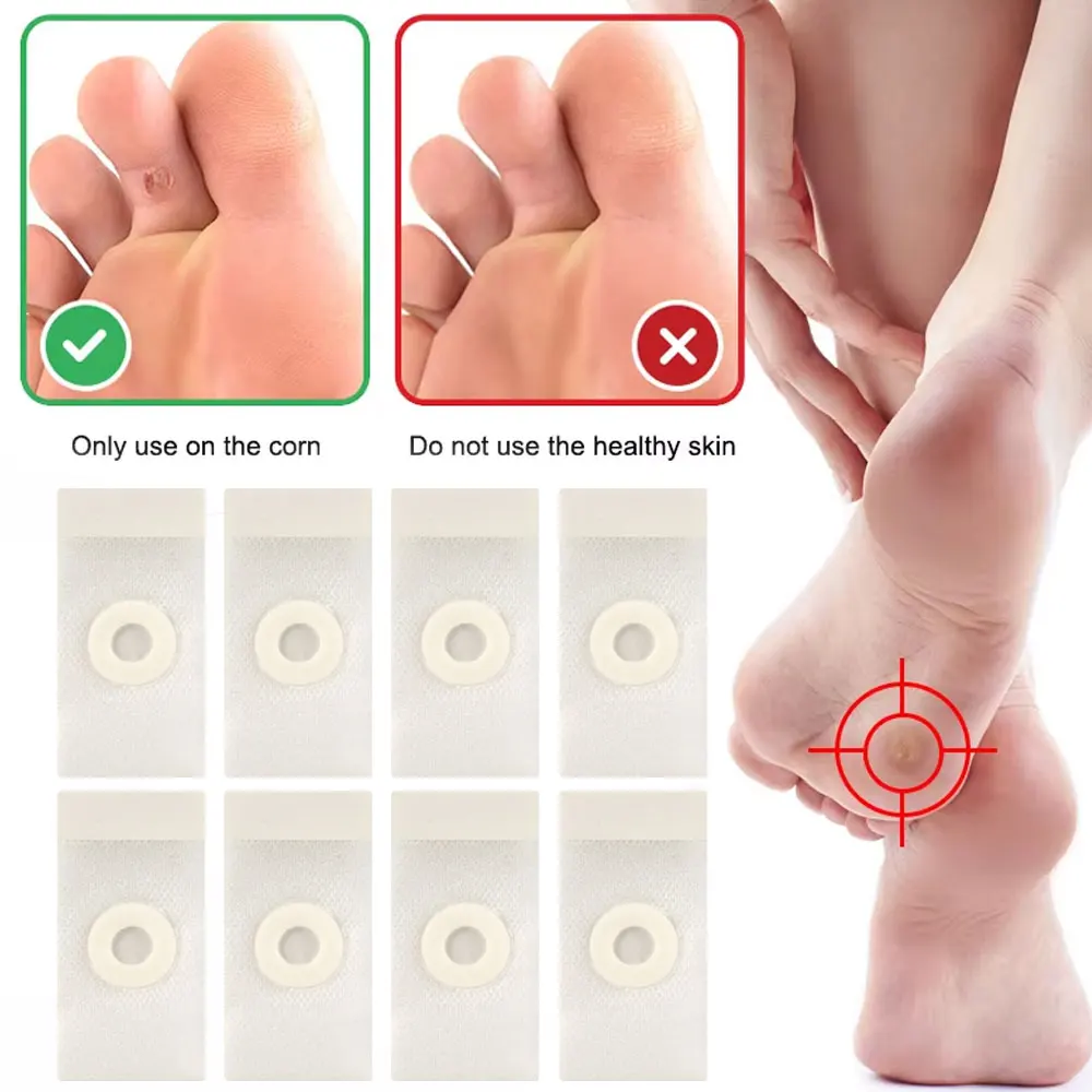 50/100Pcs Blank Corn Pads Stickers Set Foot Corn-Callus Removal Clavus DIY Plaster Foot Care Fixing Patches Feet Protector