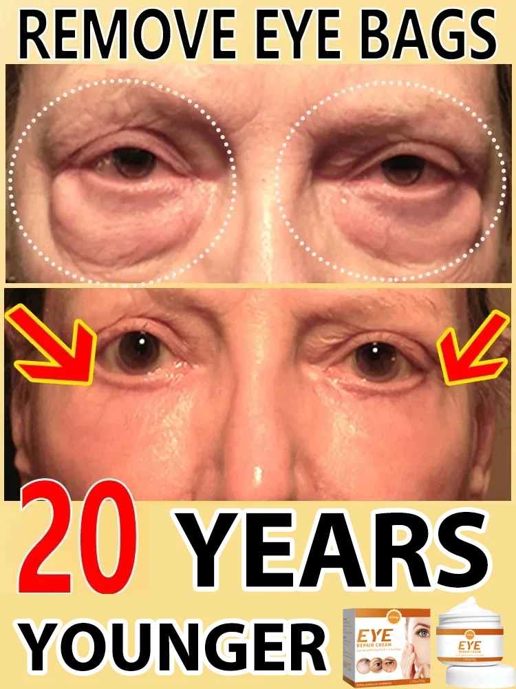 

Instant Eye Bags Removal Eyes Wrinkle Fine Line