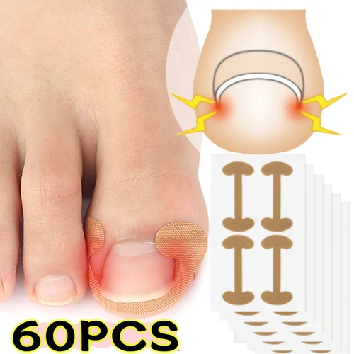 Imagen 2 del producto 20/40/60 Uds pegatinas correctoras de uñas impermeables parches correctores de uñas encarnadas tratamiento recuperar Corrector herramienta de cuidado de pedicura