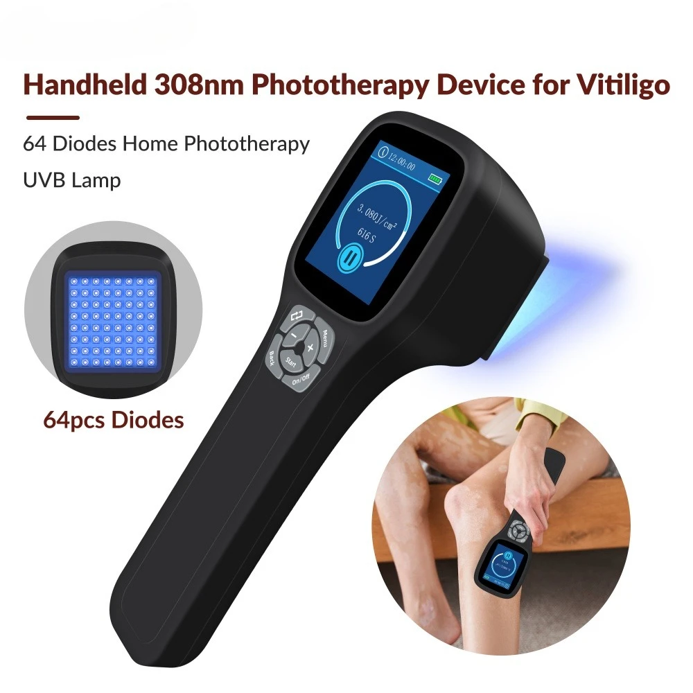

Frovab 308nm UVB Phototherapy Lamp 64 Diodes Portable Narrowband Ultraviolet Treatment for Vitiligo Psoriasis Eczema Home Use