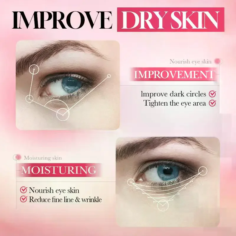 SADOER 20g Strawberry VC Eye Cream Anti Dark Circle Remover Moisturizing Eyes Contour Whitening Eyes Skin Care Products