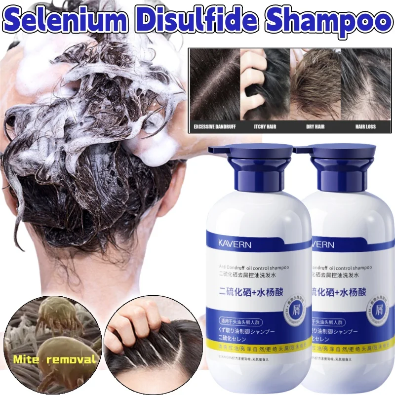 Selenium Disulfide Shampoo 500ml Oil-controlled Fluffy Anti-itchiness Scalp Hair Follicles Removal Mite Cleansing Shampoo