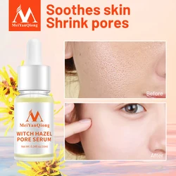 MeiYanQiong Pore Shrinking Essence Effectively Clean Pore Exfoliator Replenishes Skin Moisture Shrink Pore