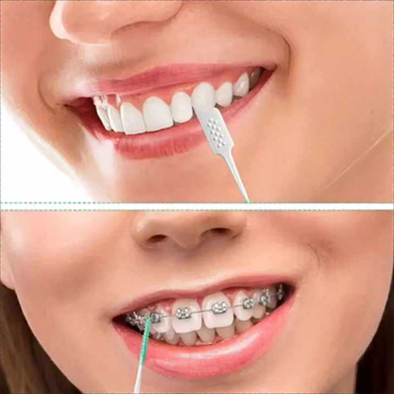 Thumbnail 3 - #49 Top Dental Floss Picks for Every Budget