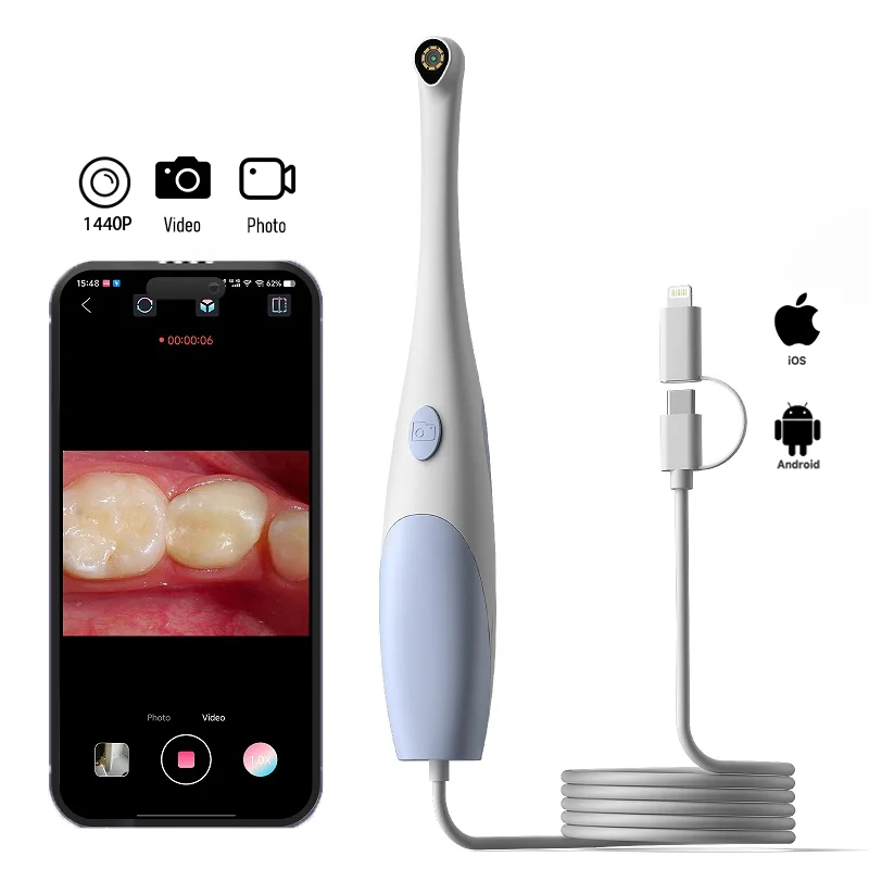 1440P Camera Oral Endoscope Portable Visual Endoscopy With 8 LED Photo /Video For Oral/Skin Examination For Android and iOS