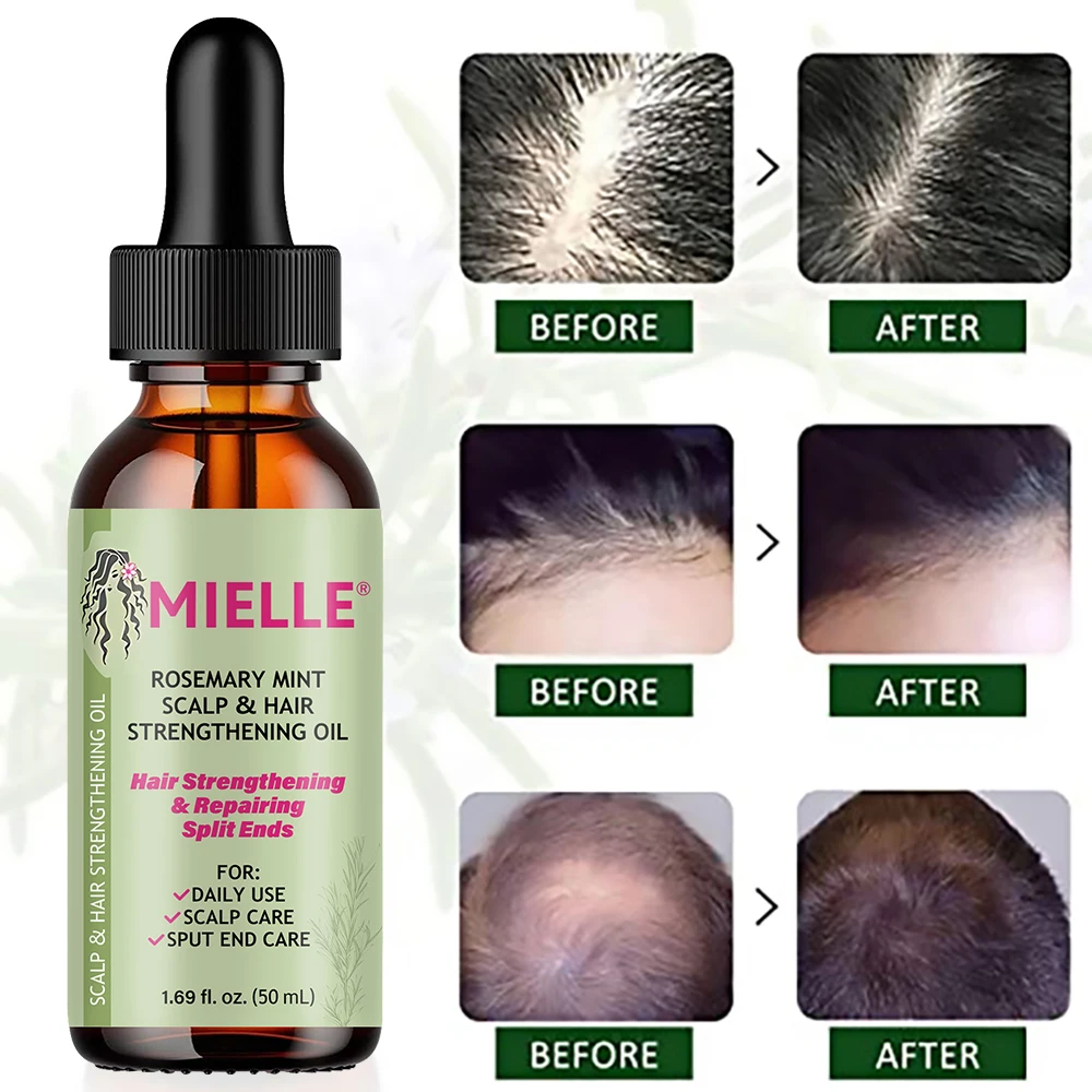 Hair Growth Essential Oil Rosemary Mint Hair Strengthening Oil Nourishing Treatment for Split Ends and Dry Mielle Organics Hair