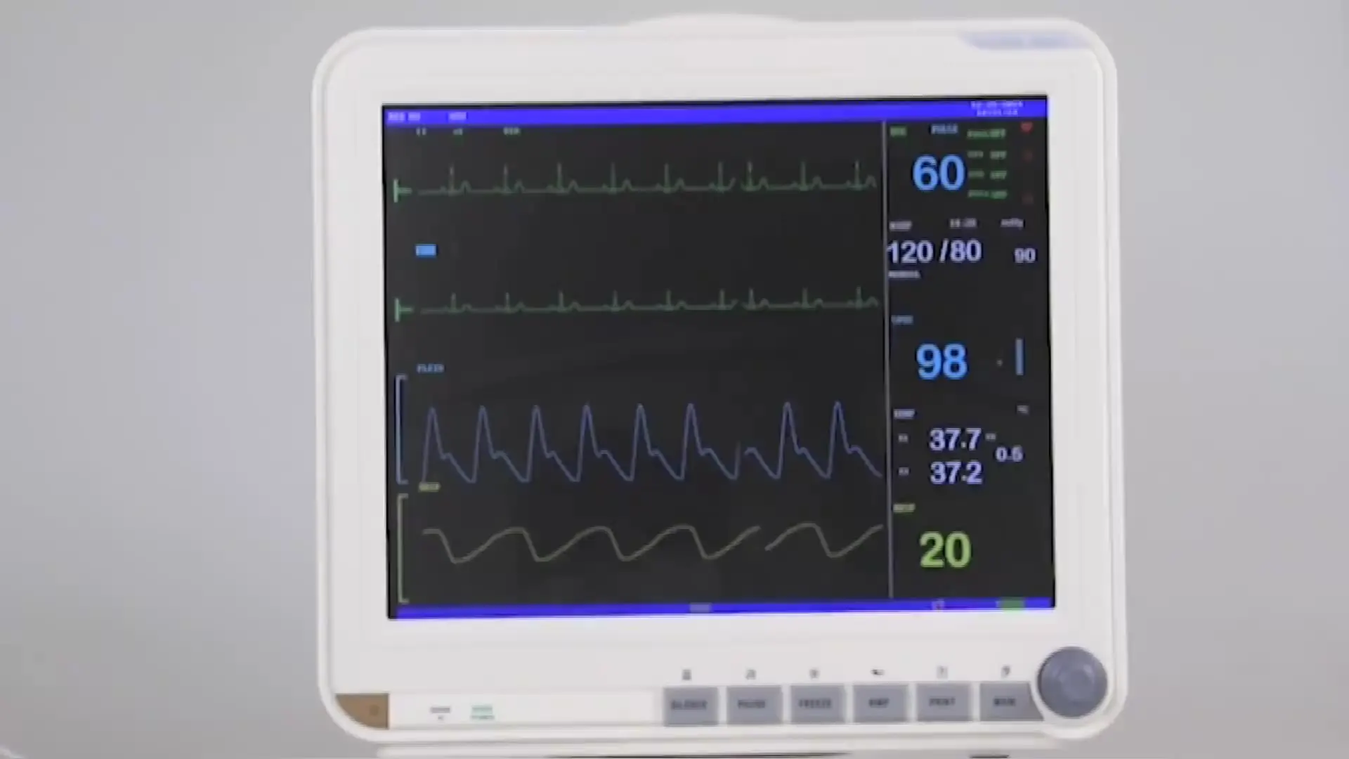 Cheap price Ex Stock pathological analysis equipments 15 inch surgical monitor with order gifts