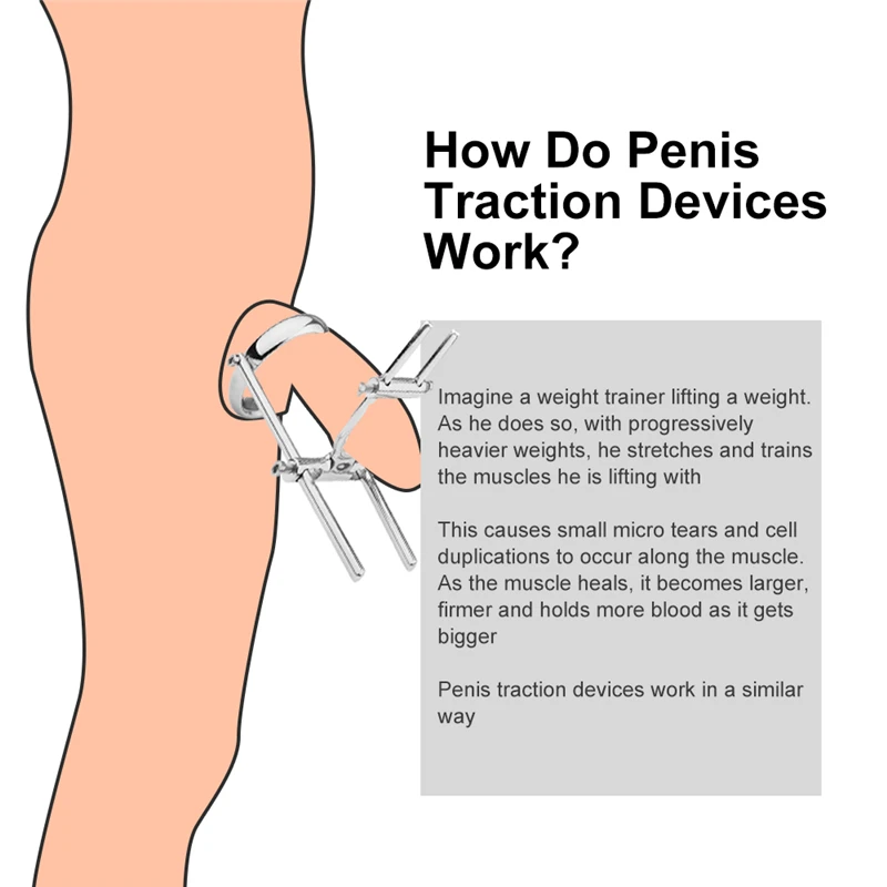 Alisador de alargamento do pénis para o crescimento do pénis, Extensor do pénis, Ampliação do pénis, Cockring Penes Ampliar, Crescimento do pénis