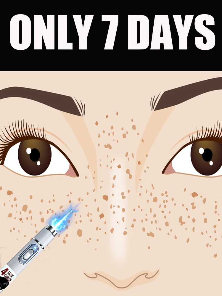 Facial care tools, blue light pen can solve a variety of problems, free shipping.