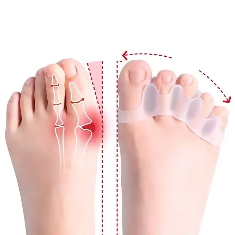 2Pc Silicone Toe Se…