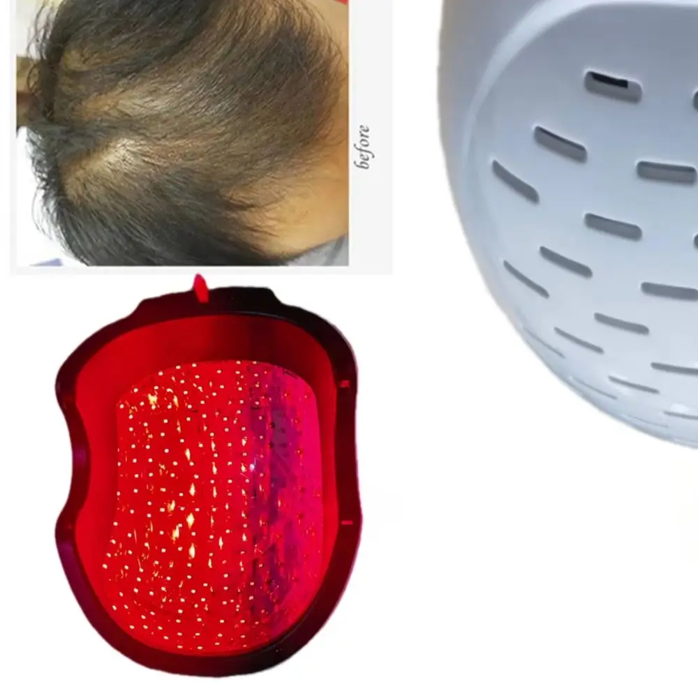 

Устройство для лечения выпадения волос — лазерная шапочка LLLT для эффективной терапии восстановления роста и утолщения волос