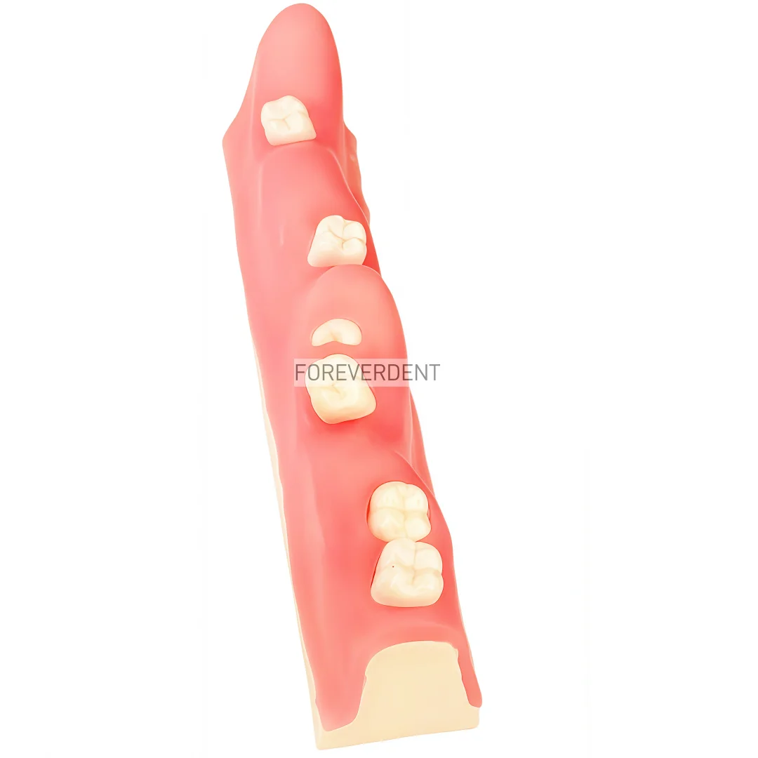 

Модель для отработки непрерывной экстракции зубов M8038: Симулятор имплантации и удаления застрявших зубов для оперативной подготовки и тестирования