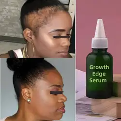 Mega Onion Growth Edge Serum, Fast Edge Growth Oil