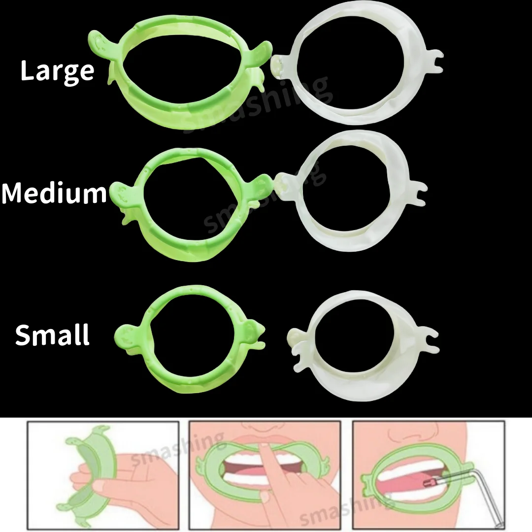 

50Pcs Dental Mouth Opener Lip Cheek Retractor Smile Face Saliva Tube Holder S/M/L