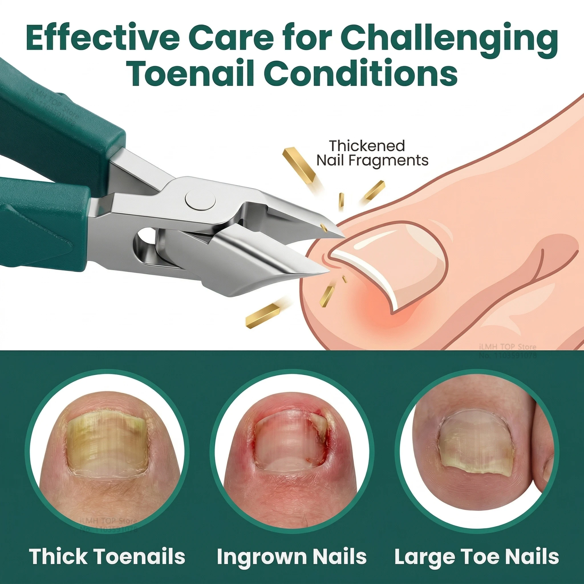 Eagle Beak Beveled Toenail Clipper for Ingrown, Wide Jaw Opening for Thick Nails, Splash-Proof Design, for Seniors Men Women