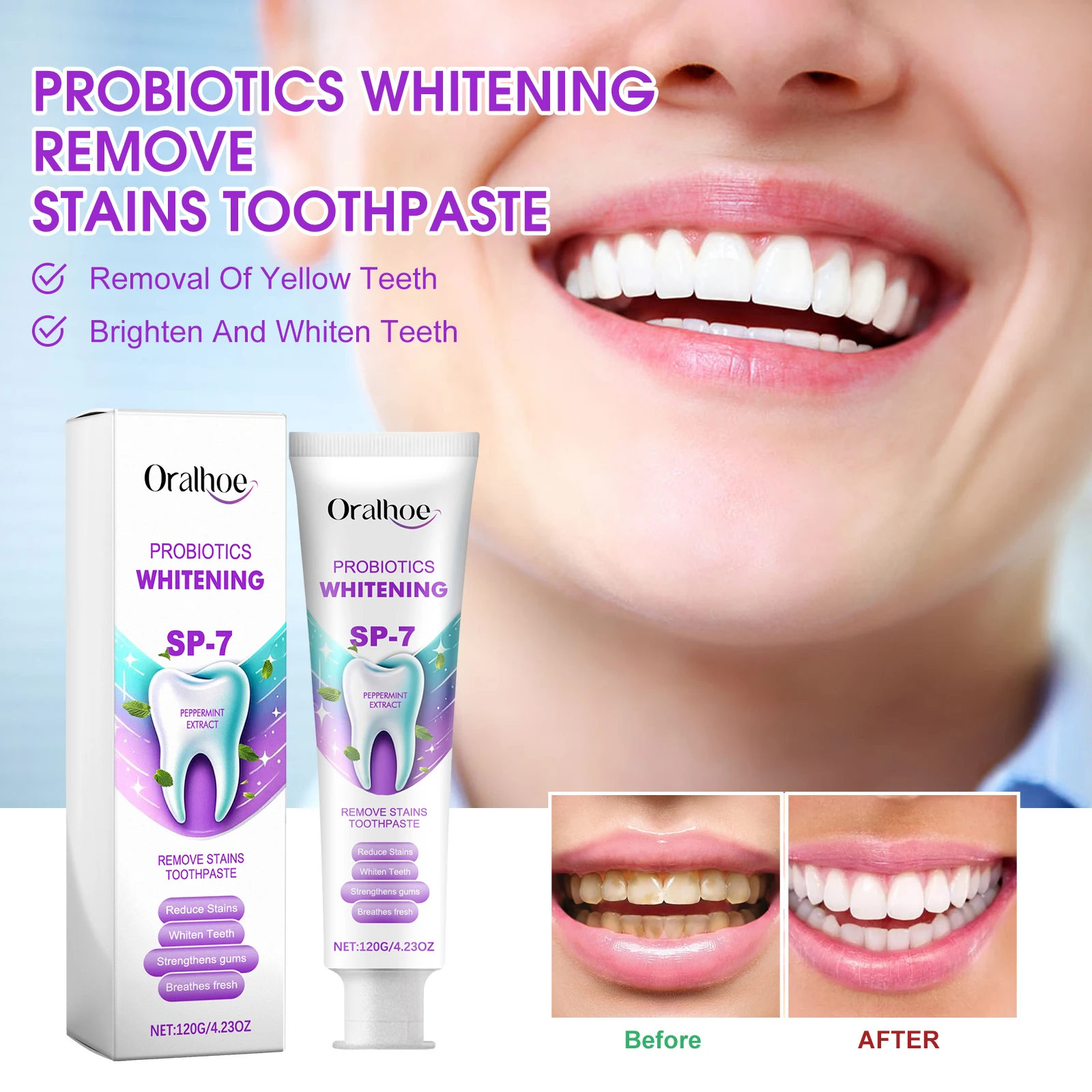 Probiotics Brightening Toothpaste Cleaning Stain Removal Freshens Breath Gentle Daily Teeth Cleaning Promote Bright Smiles - view 2