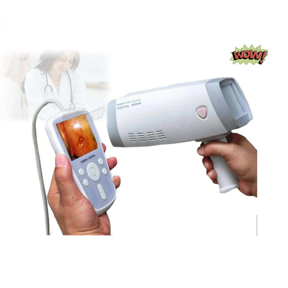 

200Y Mini Handheld Colposcopy Machine Full Digital Video Colposcope for Gynecology Exam Vagina