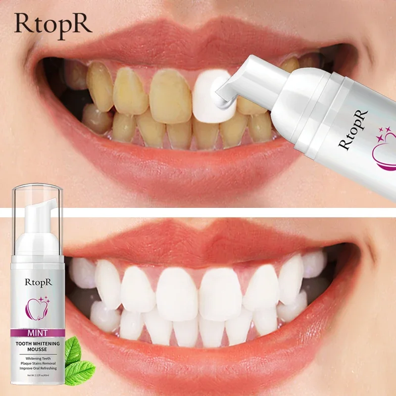 

60ML Mint Teeth Whitening Mousse Cleans The Mouth Freshens The Breath, Cleans The Stains Protects The Gums Cleans The Teeth