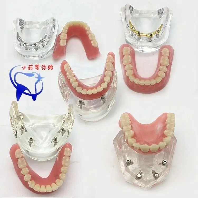 

Модель стоматологической стоматологии, модель «Доктор-паутина» 2, четыре, четыре четыре гвозди, новая модель имплантата и реставрации,
