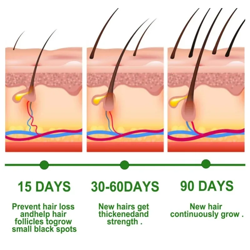 Hair Growth Serum Fast Growing Hair Care Set Essential Oil Dense Regrowth Rosemary Hair Promoting Regeneration for Women Men view 3