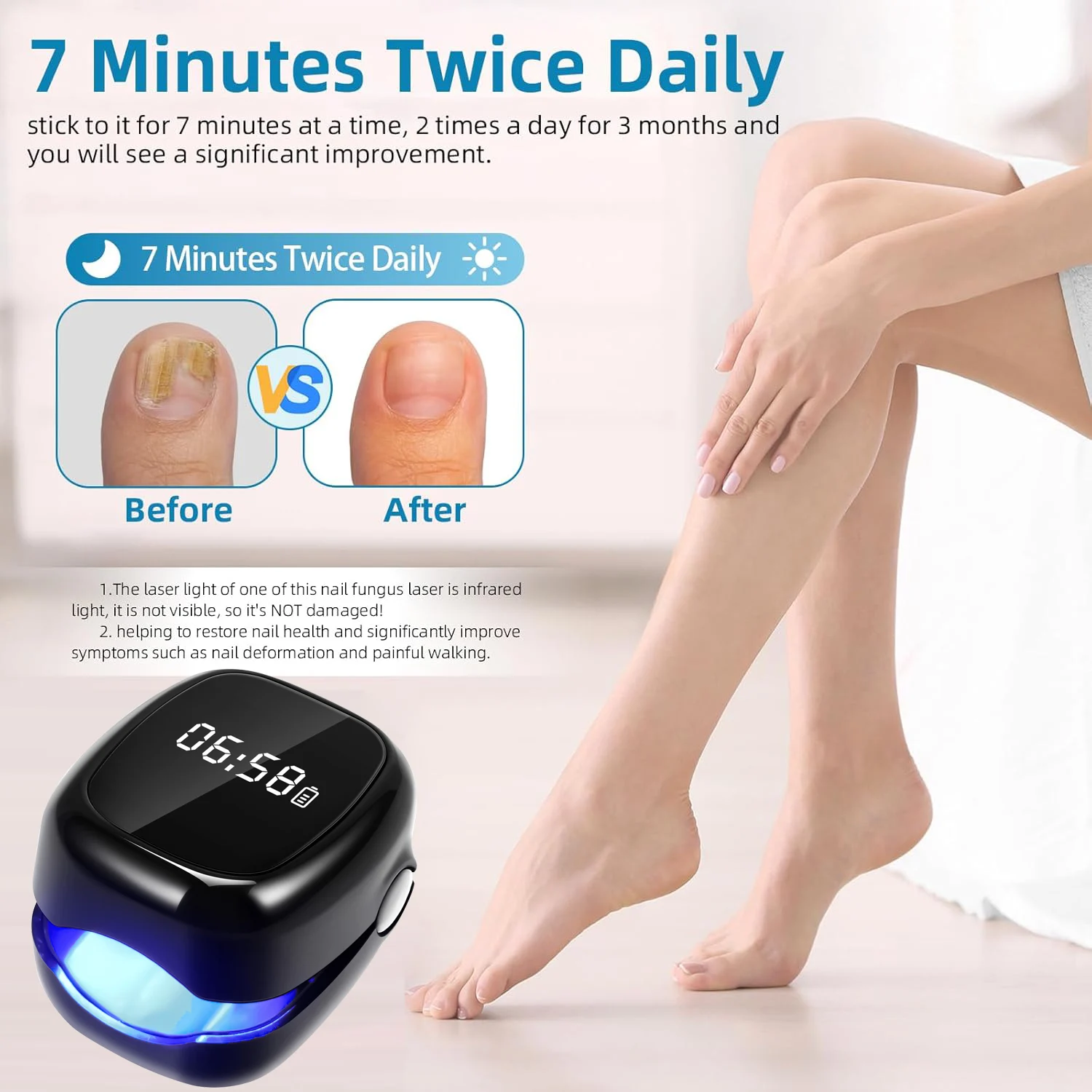 Onychomycosis Nail Laser Fungus Device Portable Nail Fungus Therapy Laser Device Repair Damaged Anti Fungal Tools USB Charge