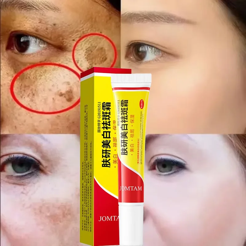 Face Brightening Cream Niacinamide Weaken Chloasma Melasma Melanin Fade Fine Lines Lighten Dark Skin Serum Care Brighten Cream