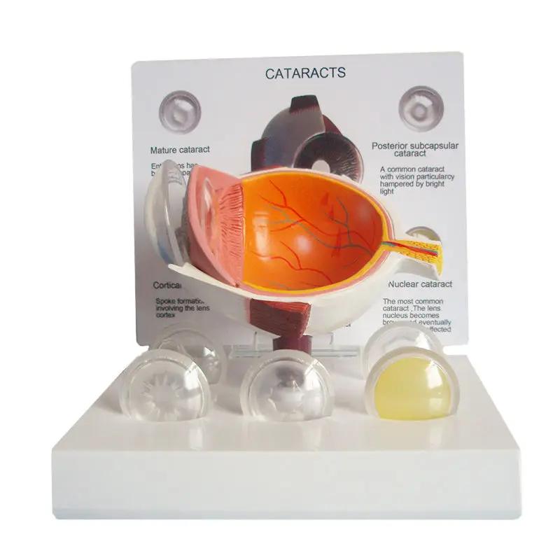 

Оптическое оборудование, медицинская обучающая модель, ПВХ, анатомия человека, патология, модель глаза, анатомическая модель катаракта человеческого глазного яблока, пластик