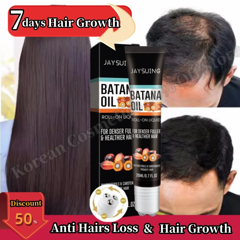 

Powerful Hair Growth Serum Anti Hairs Loss Treatment Hair Regrowth Grow Thicker Longer Hair Accelerate Growth Oil For Men Women