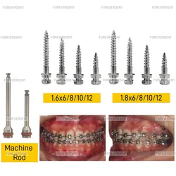 10pcs Dental Triangle Cap Micro Screw Orthodontic Matching Tool Screwdriver Driver for Implants Self Drilling Tool Screw Tool