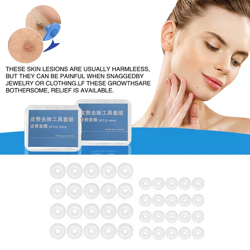 20 Unidades/Caja Bandas de Goma No Tóxicas para Eliminar Nevus y Verrugas, Kit de Tratamiento para Hombres y Mujeres, Cuidado Facial