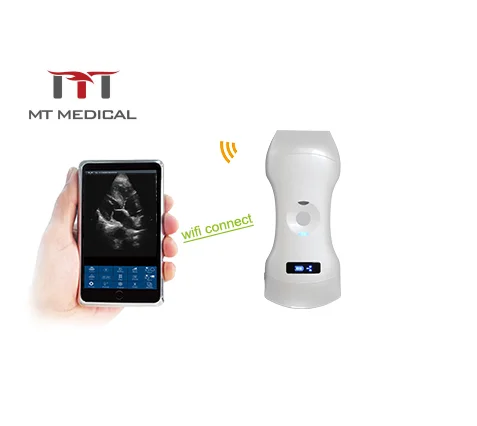 3 in 1 WiFi Ultrasound Scanner Color 192 Elements Wireless Probe Medical Ultrasound for Hospital Wireless Function Included