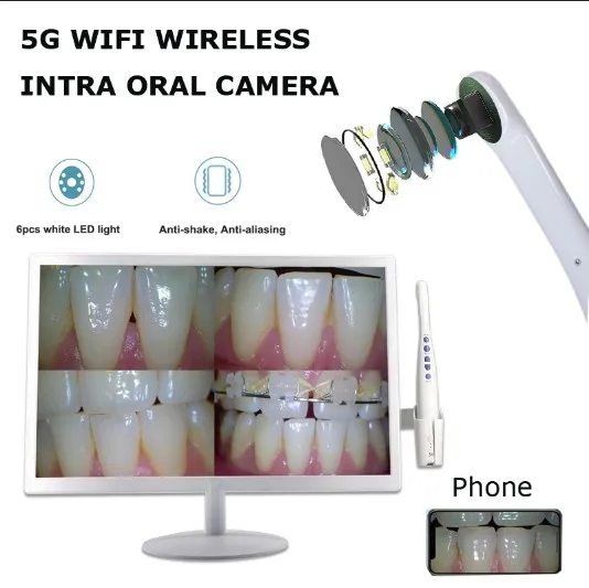 Wireless Dental Product for Oral Camera with Big Screen/connect to Dental Chair Camera Intra Oral Product