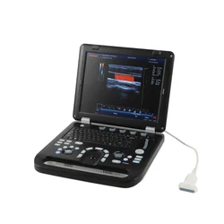 Factory price human portable 3d colour doppler ultrasound scanner machine sonography