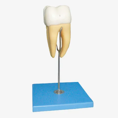 16 times Enlarged Molar Teeth Model, Dental Caries Model