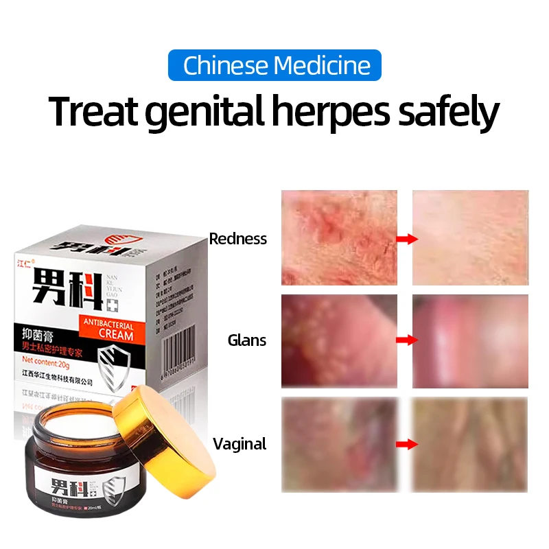 Genital Herpes Genitals Outbreak Cream Chinese Medicine Treatment Balanitis Cure Gonorrhea Syphilis Killer Std